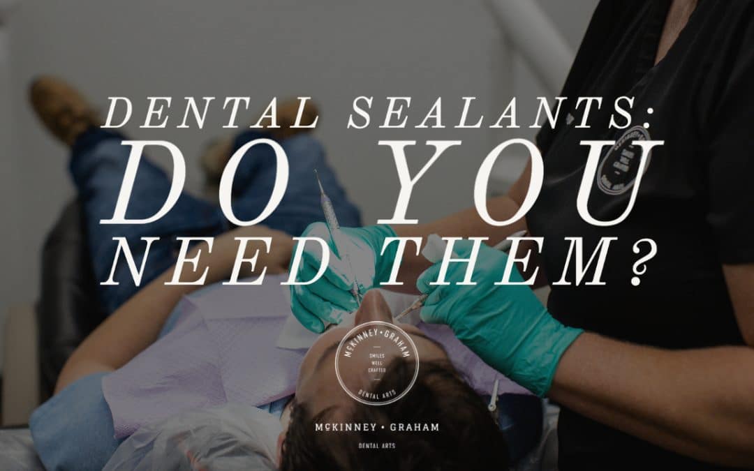 Dental Sealants: Do you need them?