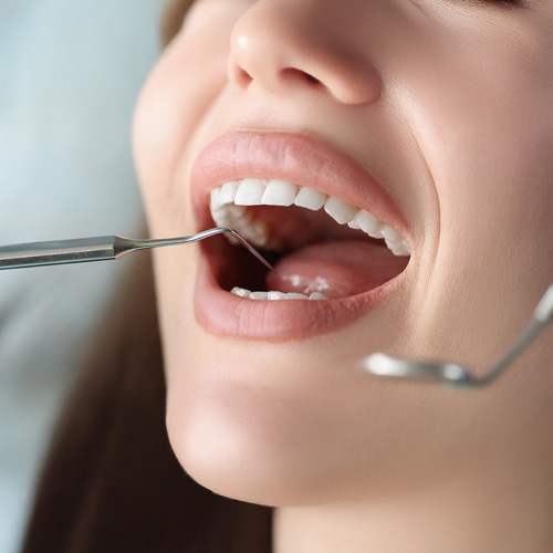 Patient receiving a comprehensive dental exam to check for cavities, gum disease, and oral health issues.