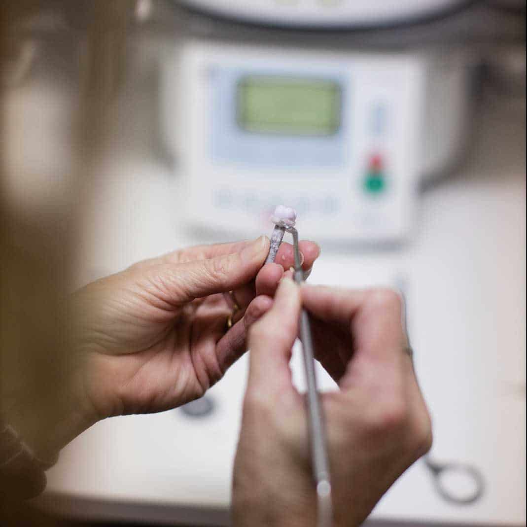 Dentist preparing a tooth for a CEREC same day crown treatment