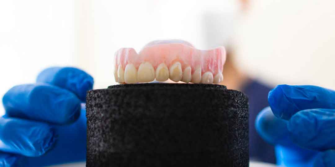 Full denture model displayed on a stand for patient restoration options