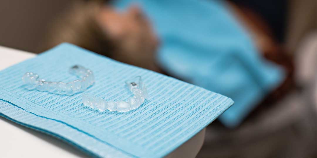 Clear orthodontic aligners displayed on a tray during consultation