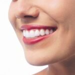 Close-up smile showing the comfortable fit of Invisalign aligners