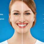 Smiling woman demonstrating the invisible appearance of Invisalign aligners