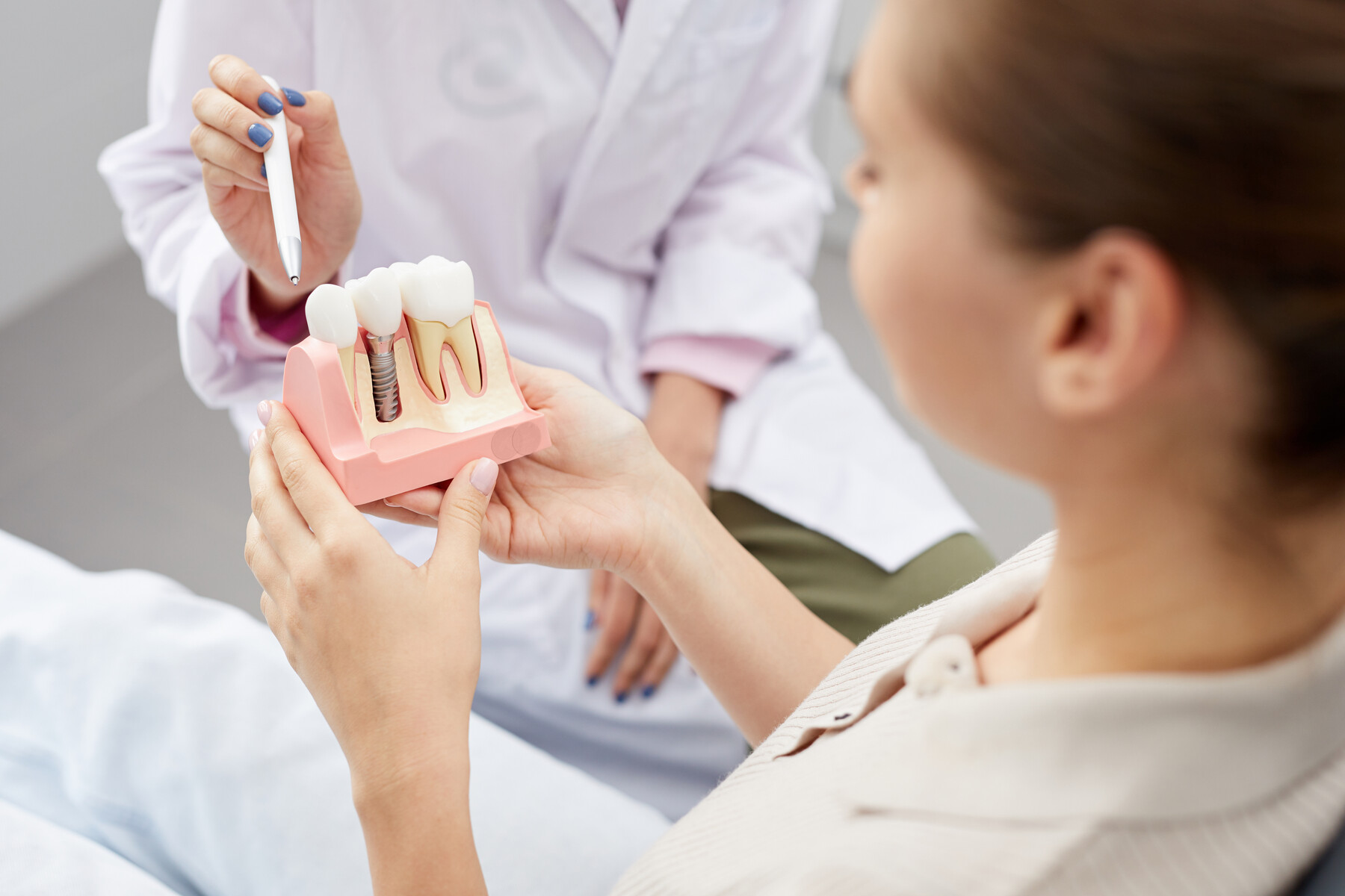 Featured image for “Dental Implant Timeline”